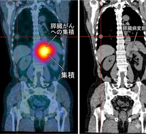 確定診断とマーカー